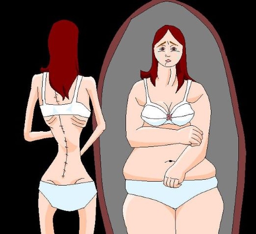Anorexie, co to je a kde hledat pomoc? 